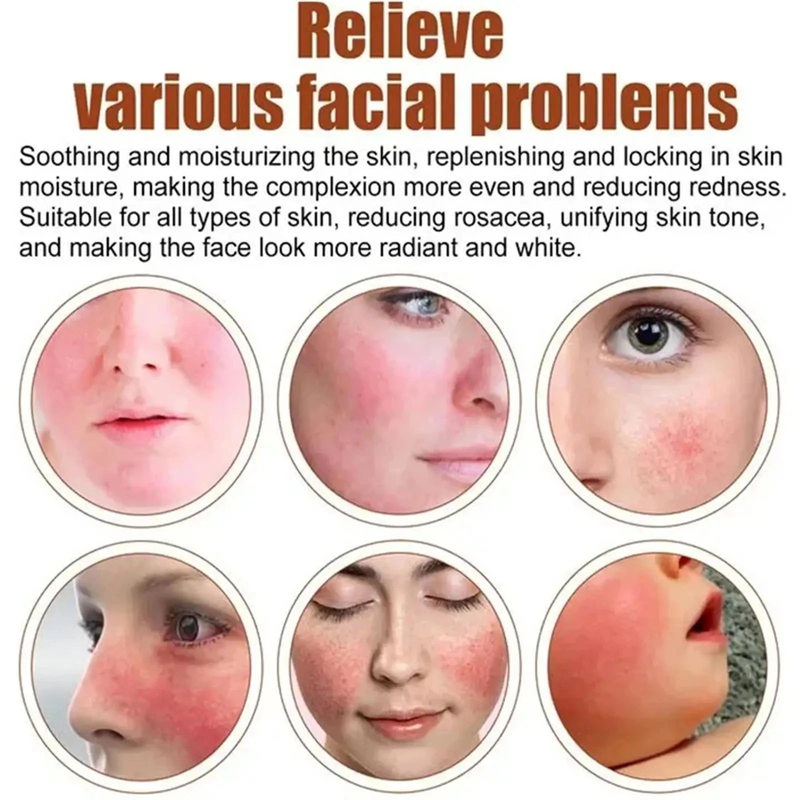 Facial Redness Repair Cream Improve Sensitive Muscles Acne Rosacea Dry&Itchy Skin Moisturizer Lotion Korean skincare products