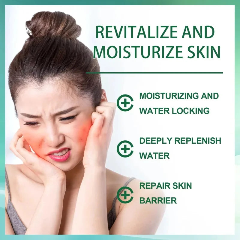Facial Redness Repair Cream Improve Sensitive Muscles Acne Rosacea Dry&Itchy Skin Moisturizer Lotion Korean skincare products